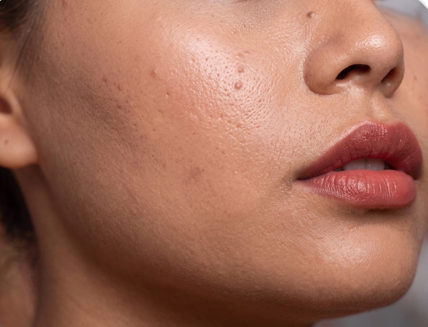 Barrier repair skin concern