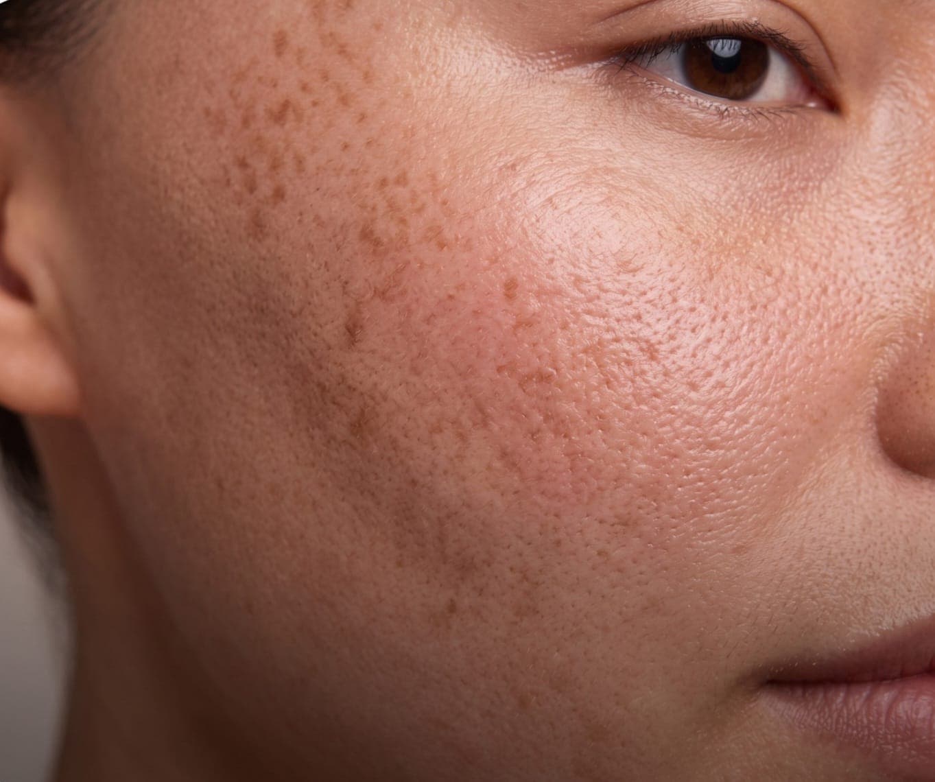 Dry skin concern