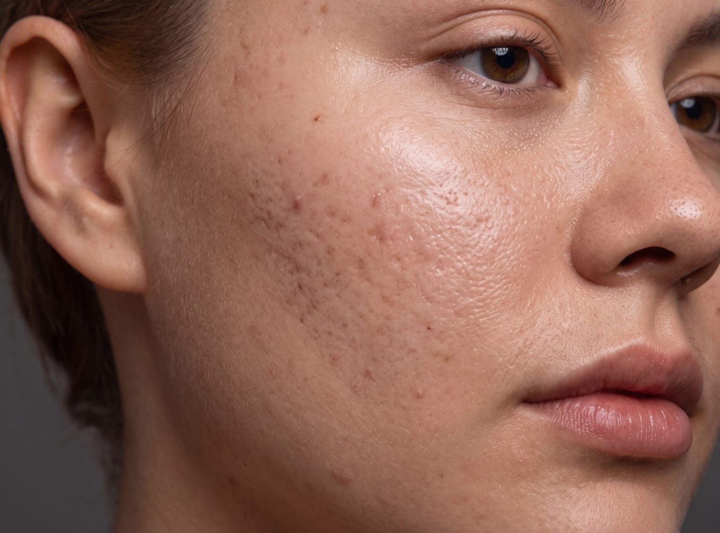 Sensitive skin concern